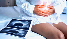 Признаки внематочной беременности на УЗИ: на каких сроках определяются